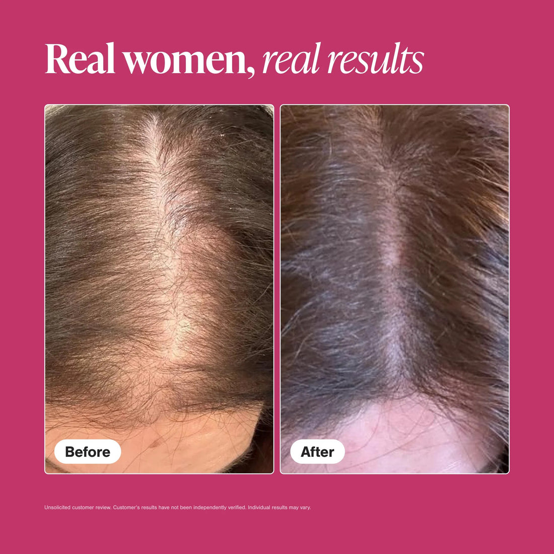Viviscal Vrouw Haargroei Supplement 180 Stuks